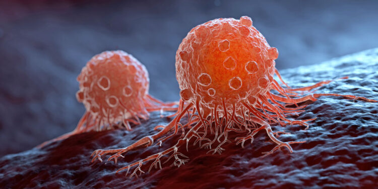 Necesario hablar de prevención y de diagnóstico oportuno del cáncer, especialistas