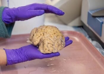 El cerebro de los ‘superancianos’ ofrece algunas claves de la eterna juventud