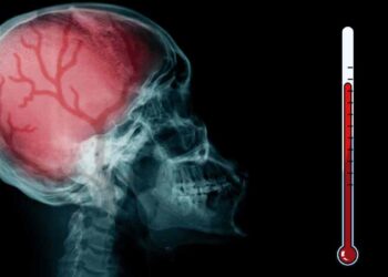 Brote “sin precedentes” de meningitis afecta a Reino Unido, reportan dos muertos