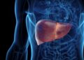 La ciencia reta por primera vez la irreversibilidad de la cirrosis por MASH