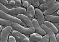 Alertan por la presencia de una bacteria carnívora en costas de Louisiana; aumentan los casos