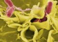 ¿Salmonella u otra infección? Por qué un diagnóstico rápido puede marcar la diferencia